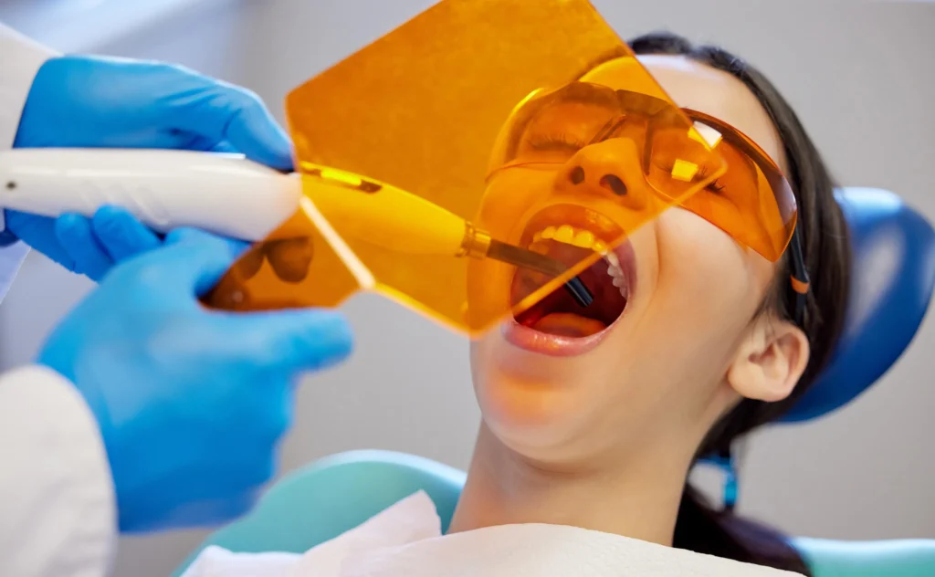 Fissaggio intarsio dentale 