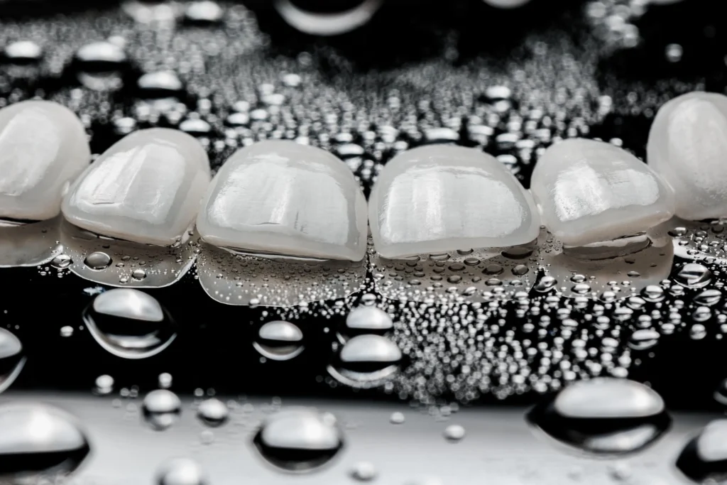 faccette in ceramica per denti