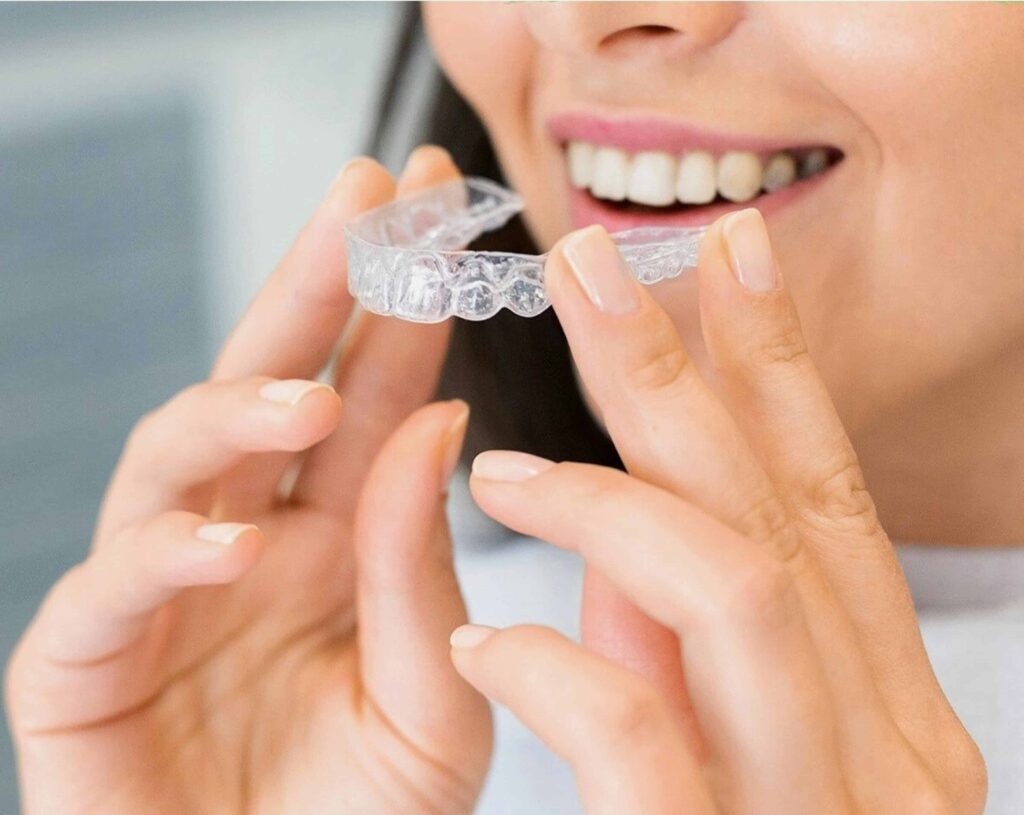 Allineatori per denti trasparenti per la correzione della malocclusione dentale 