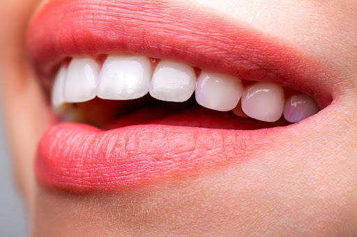 Connessione tra estetica del sorriso e salute dentale