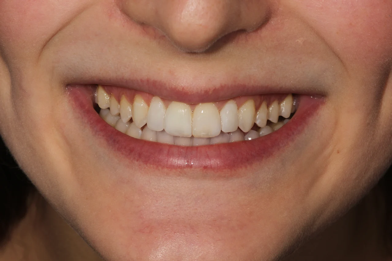 sorriso tonico caso margherita dopo